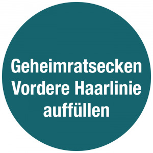 Geheimratsecken und vordere Haarlinie transplantieren, Geheimratsecken und vordere Haarlinie auffüllen - Haartransplantation Österreich