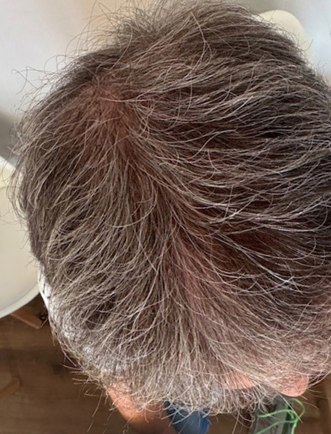 vorher-nachher-kollerhair_07-2025-nachher